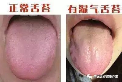 Nine Tongue Signs Indicating Qi Deficiency: Timely Adjustment and Medical Attention Recommended