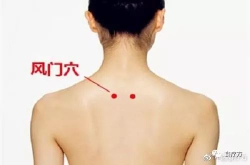 Comprehensive Guide to Cupping Therapy for the Back