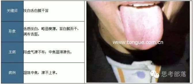 Comprehensive Guide to Tongue Diagnosis (8): 72 Types of Tongue Diagnosis Charts
