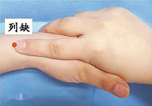 Traditional Chinese Medicine Treatment for Wind-Cold Headache