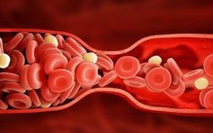 Unblocking Blood Stasis for Overall Wellness: 4 Chinese Patent Medicines for Circulation