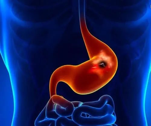 Symptoms of Spleen and Stomach Yang Deficiency and Dietary Therapy in Winter