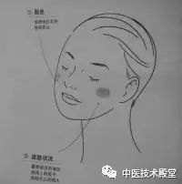 Observational Diagnosis in Traditional Chinese Medicine
