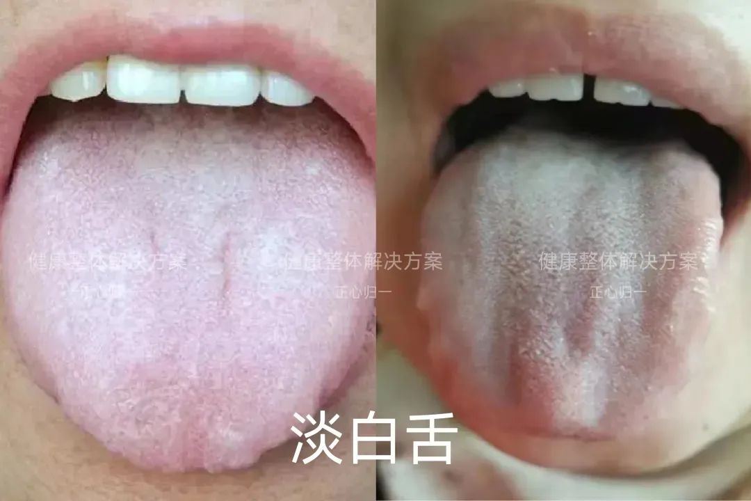 Observing the Tongue for Health: How to Analyze Tongue Quality?