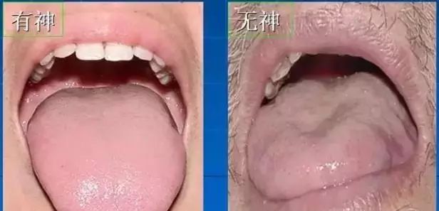 The Most Comprehensive Guide to Tongue Diagnosis! Master It and Become a Tongue Diagnosis Expert