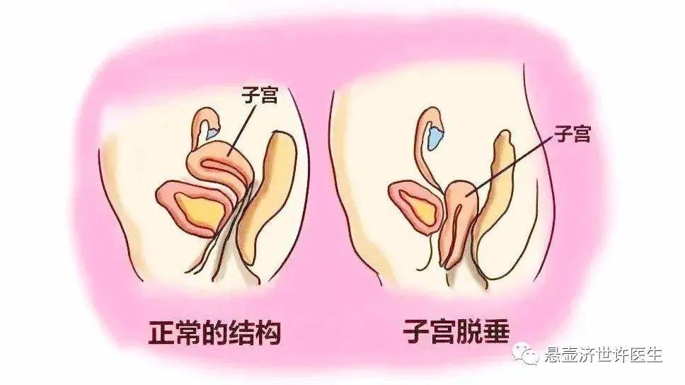 Understanding Qi Deficiency in Traditional Chinese Medicine
