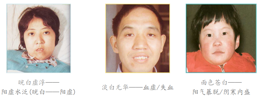 Diagnosis in Traditional Chinese Medicine
