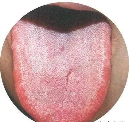 130 High-Definition Tongue Diagnosis Charts (Recommended for Collection)