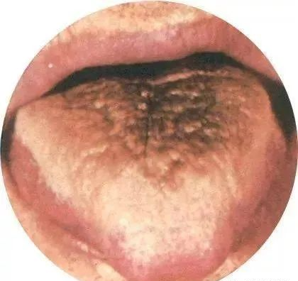 130 High-Definition Tongue Diagnosis Charts (Recommended for Collection)