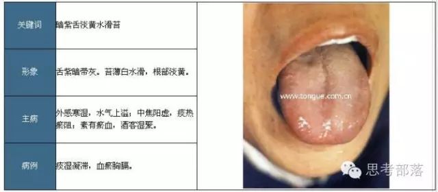 Comprehensive Guide to Tongue Diagnosis (8): 72 Types of Tongue Diagnosis Charts