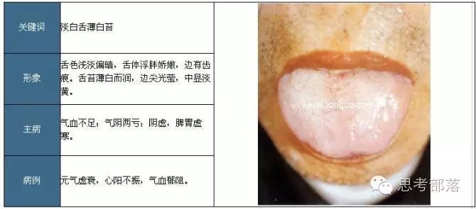 Comprehensive Guide to Tongue Diagnosis (8): 72 Types of Tongue Diagnosis Charts
