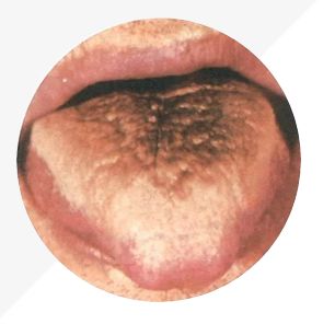 Analysis of High-Definition Tongue Diagnosis Charts: Understanding Health Through Your Tongue (Part 1)