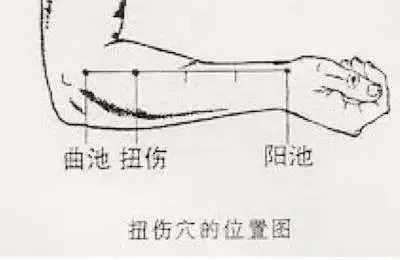 47 Unique Acupuncture Points Worth Seeing! (Collector's Edition)