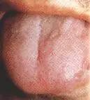 Comprehensive Guide to Tongue Diagnosis: Easily Understand Your Health Condition