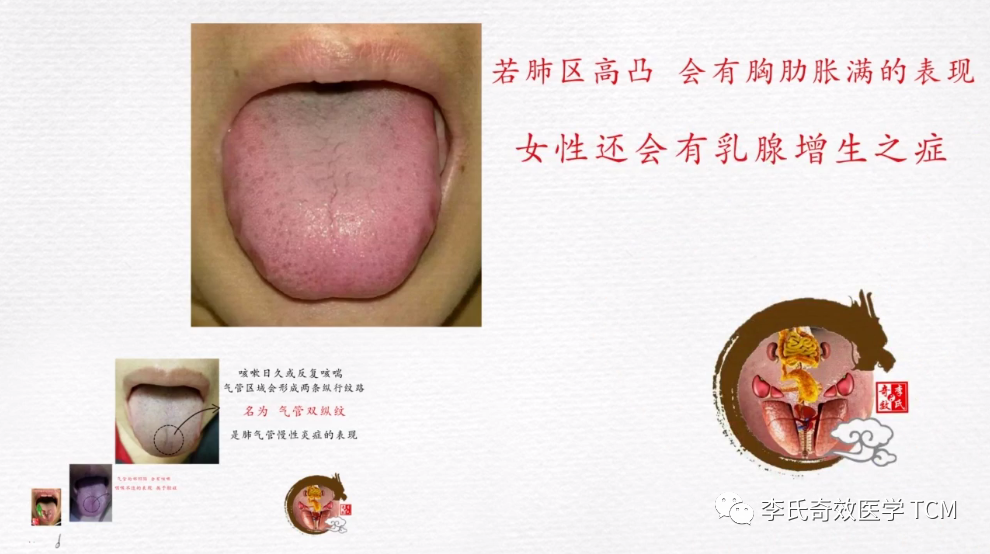 Tongue Diagnosis and the Lungs (Animated Version)
