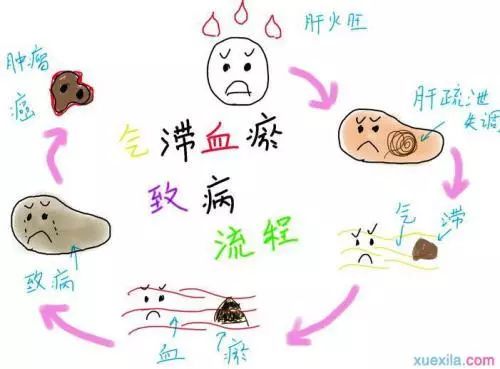 Blood Stasis Syndrome