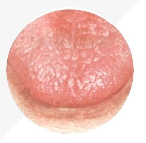 Analysis of High-Definition Tongue Diagnosis Charts: Understanding Health Through Your Tongue (Part 1)