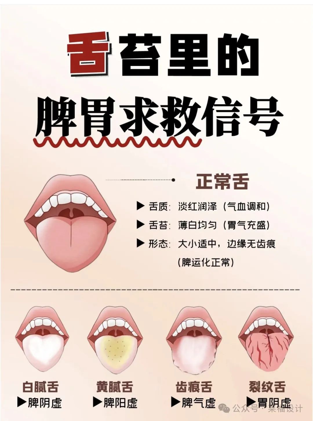 Analyzing Your Baby's Tongue Coating to Determine Spleen and Stomach Accumulated Heat