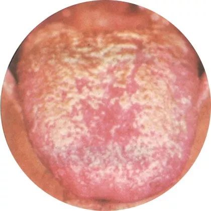 Comprehensive Tongue Diagnosis Guide