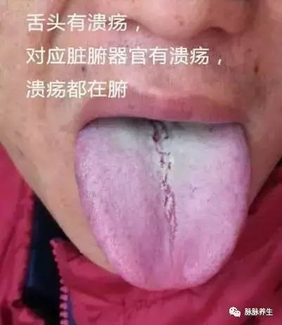 Tongue Diagnosis: A Clear Insight
