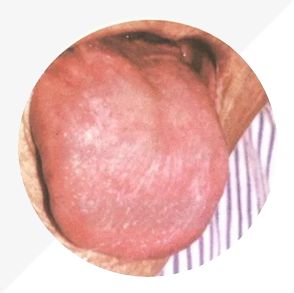 Understanding Tongue Diagnosis in TCM: Insights into Health from Tongue Appearance (Part 2)