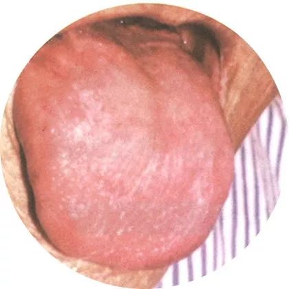 The Most Comprehensive High-Definition Real Tongue Diagnosis: Observing Tongue Patterns to Understand Internal Organs (Collection Edition)