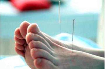 Acupuncture Techniques (A Must-Read for Acupuncturists)
