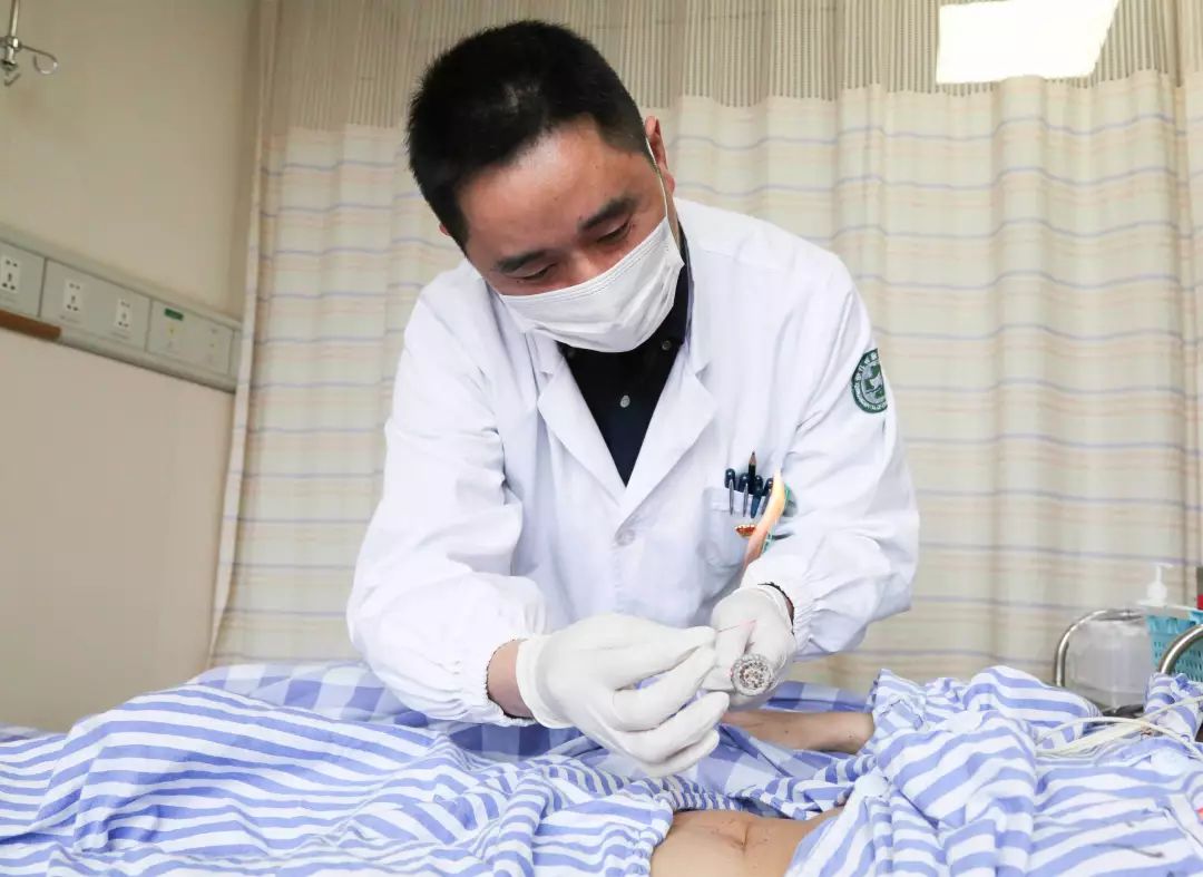Why Can a Tiny Silver Needle Suppress Tumors? Experts Reveal the Secrets of 'Needles and Fire'!