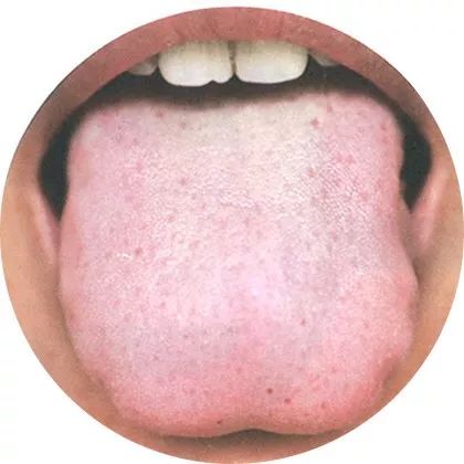 The Most Comprehensive High-Definition Real Tongue Diagnosis: Observing Tongue Patterns to Understand Internal Organs (Collection Edition)