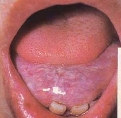 62 High-Definition Tongue Diagnosis Charts with Illustrations (Collector's Edition)