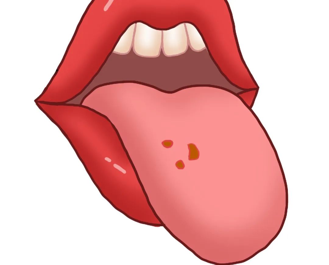 The Tongue as a Reflection of Health: A Quick Self-Check!