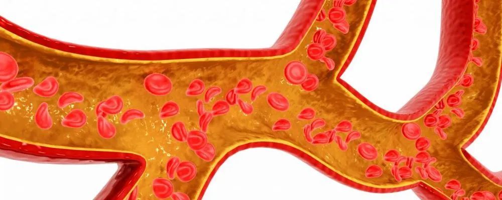 Characteristics of Blood Stasis and How to Regulate It