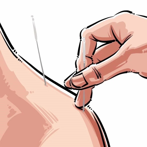 Acupoint Knowledge | Twelve Meridians: The Weizhong Point of the Foot Taiyang Bladder Meridian