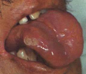 62 High-Definition Tongue Diagnosis Charts with Illustrations (Collector's Edition)