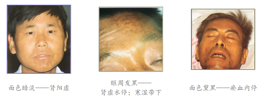 Diagnosis in Traditional Chinese Medicine