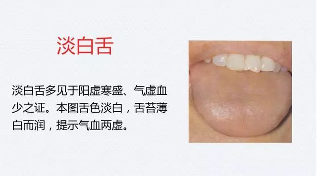 The Most Comprehensive TCM Tongue Diagnosis Atlas: Observe the Tongue, Understand the Whole Body!