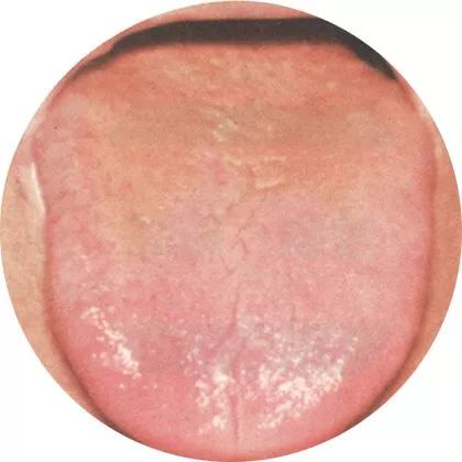 The Most Comprehensive High-Definition Real Tongue Diagnosis: Observing Tongue Patterns to Understand Internal Organs (Collection Edition)