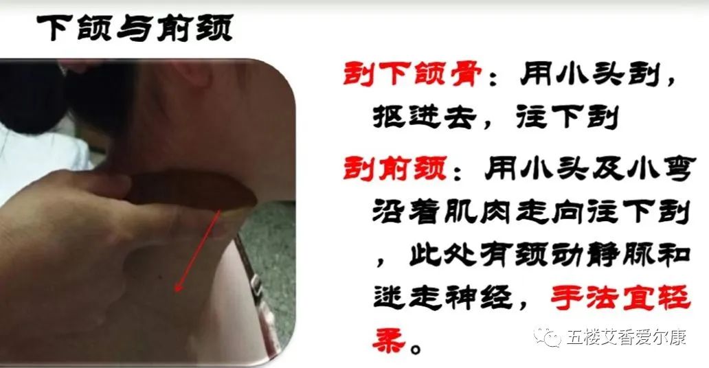 Summary of Common Diseases and Gua Sha Treatment Plans Including Human Reflex Maps, Contraindications, and Diagnosis of Sha Patterns