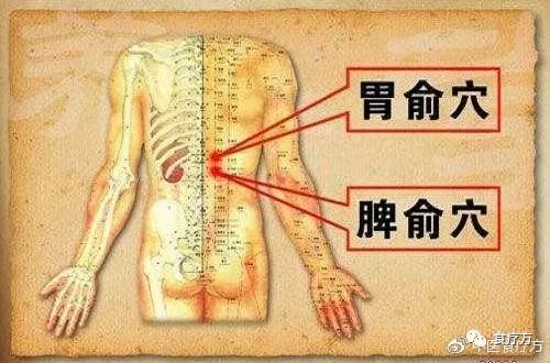 Comprehensive Guide to Cupping Therapy for the Back