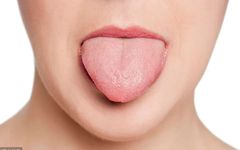 Traditional Chinese Medicine: Qi Deficiency Is More Than Just Sweating! 9 Tongue Signs Indicating Qi Deficiency Explained