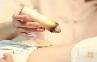 What Are the Classifications of Moxibustion?