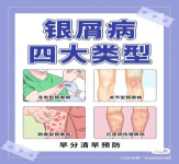 Fire Needle Therapy: A Unique Tool of Traditional Chinese Medicine