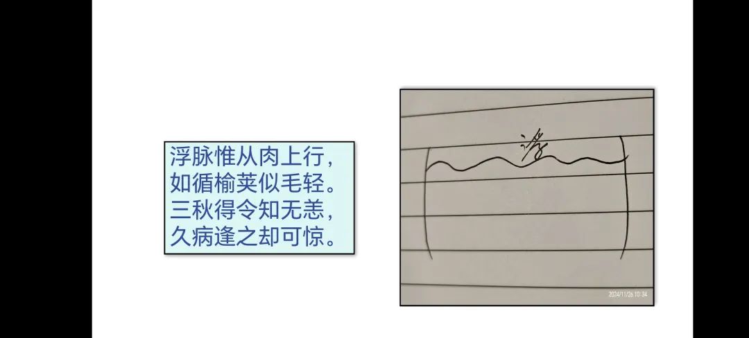 The Floating Pulse: An Insight into TCM Pulse Diagnosis