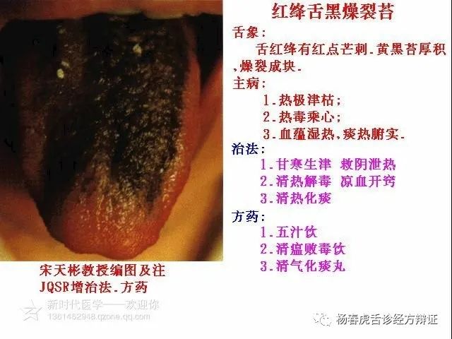 Foundations of Traditional Chinese Medicine: Phlegm-Dampness