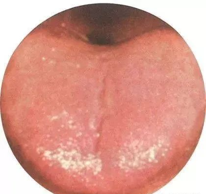130 High-Definition Tongue Diagnosis Charts (Recommended for Collection)