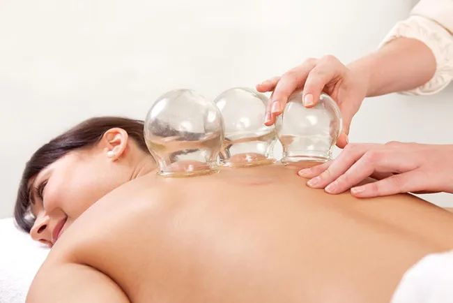 Cupping Therapy: A Traditional Chinese Medicine Approach to Health
