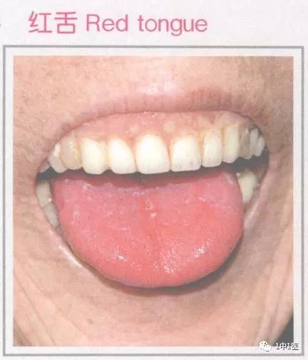 Learning Tongue Diagnosis from Scratch 5 - Tongue Color 3