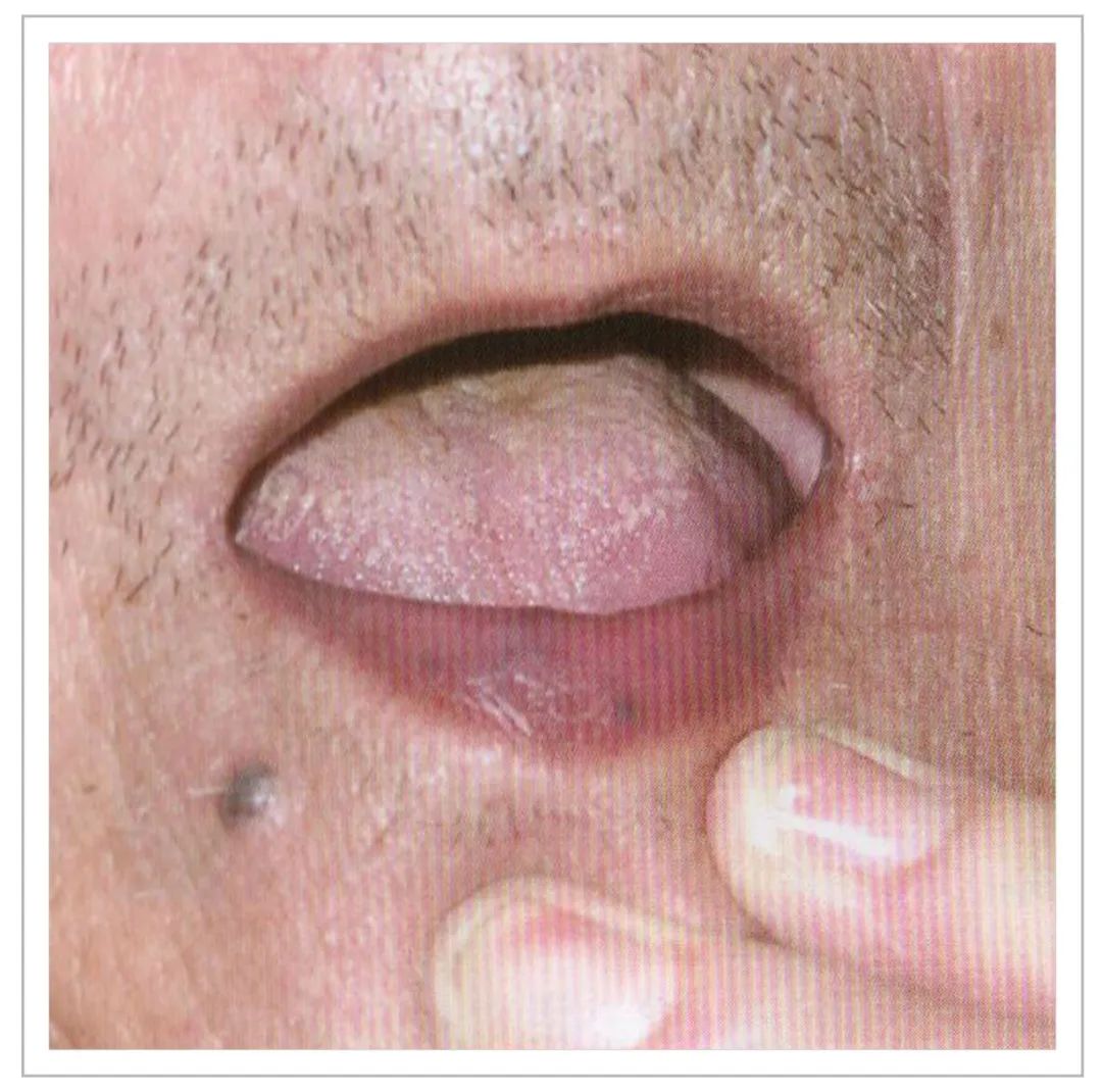 Analysis of Tongue Quality and Movement in Traditional Chinese Medicine