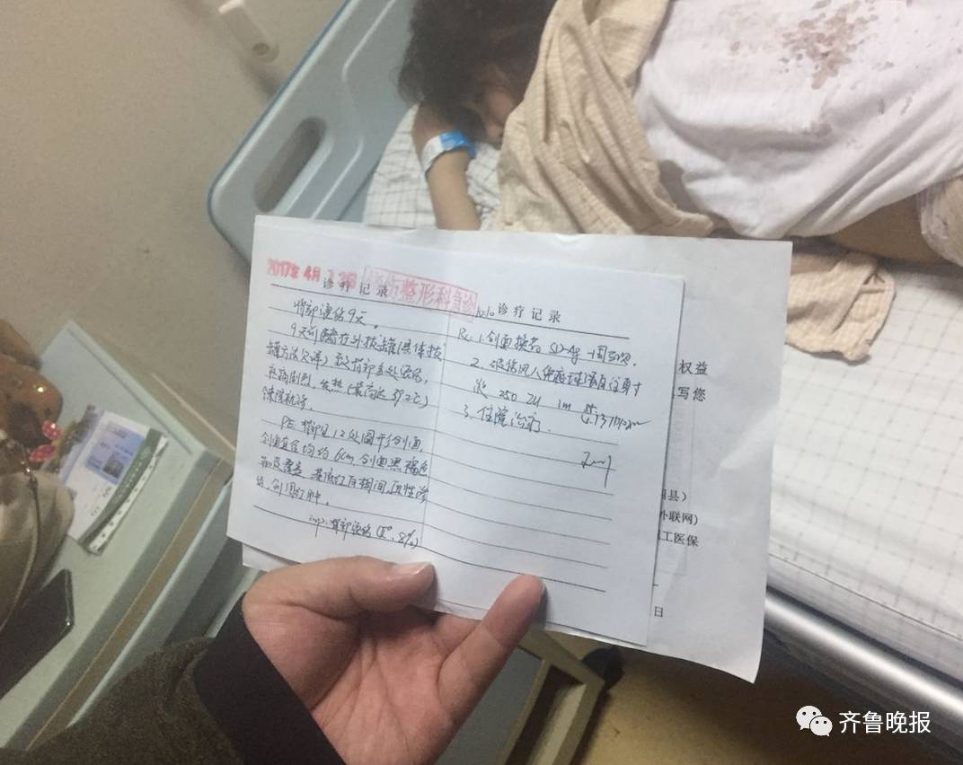 Woman Suffers Severe Burns and Coma After Intensive Cupping Therapy: The Risks of Cupping Explained