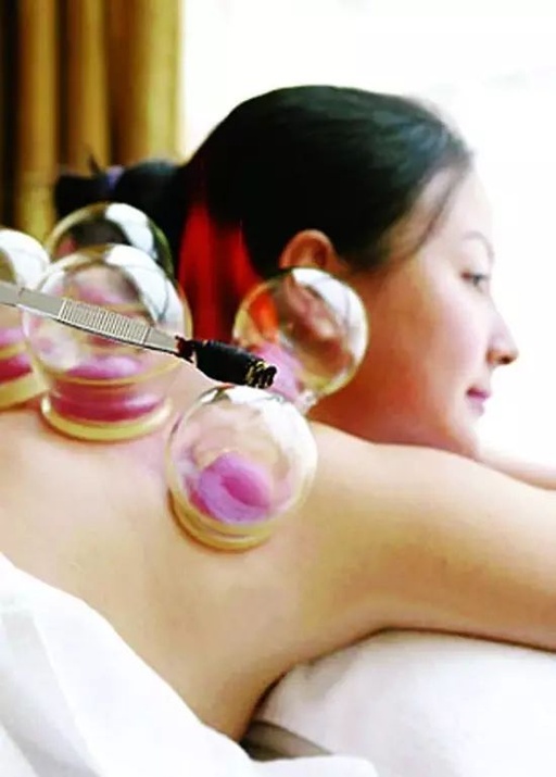 The Benefits of Bloodletting Therapy in Traditional Chinese Medicine